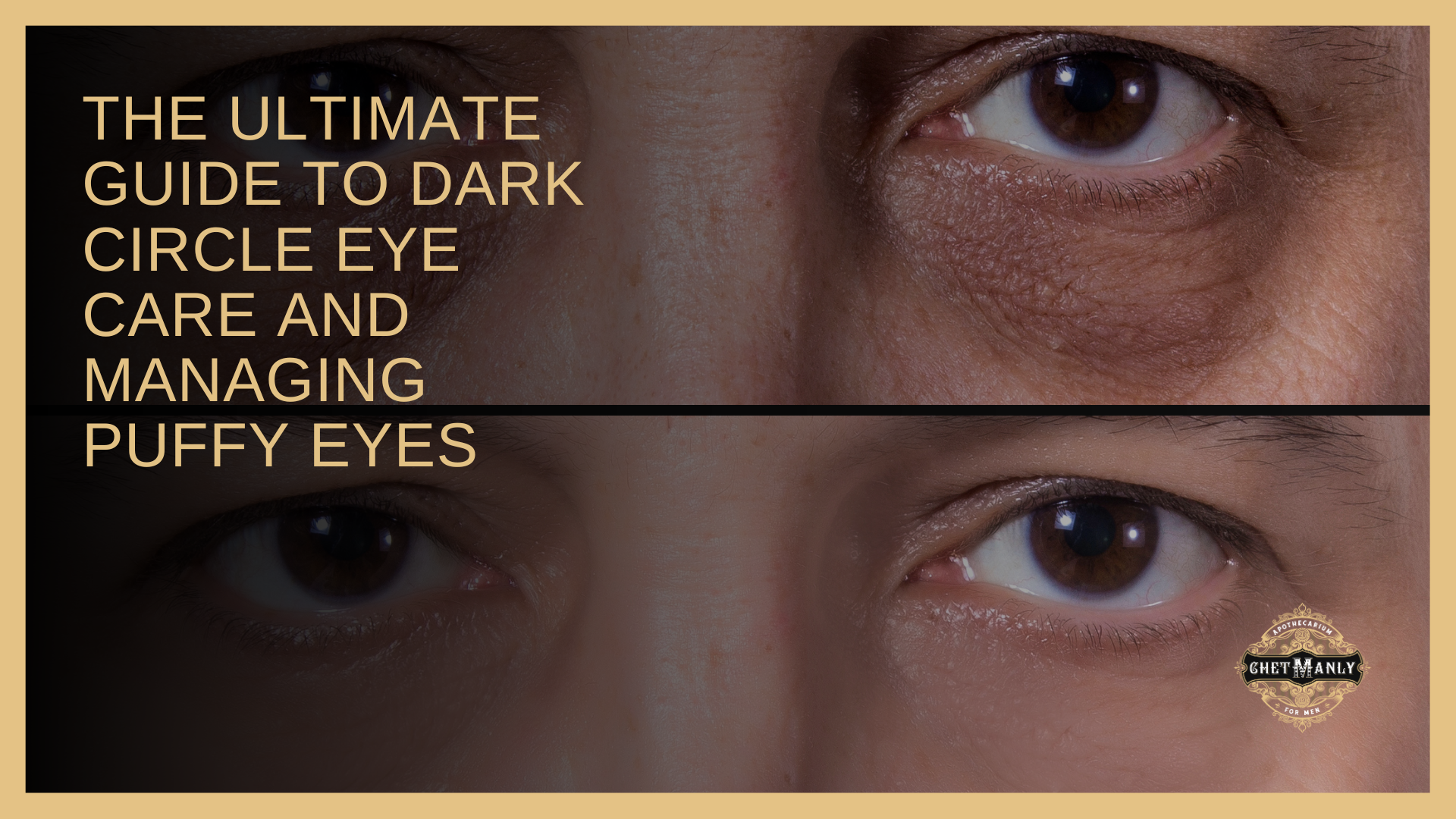 The Ultimate Guide to Dark Circle Eye Care and Managing Puffy Eyes